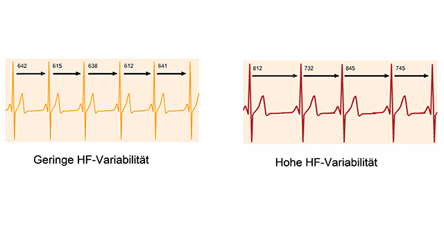 Abbildung hoher und geringer Herzfrequenzvariabilität